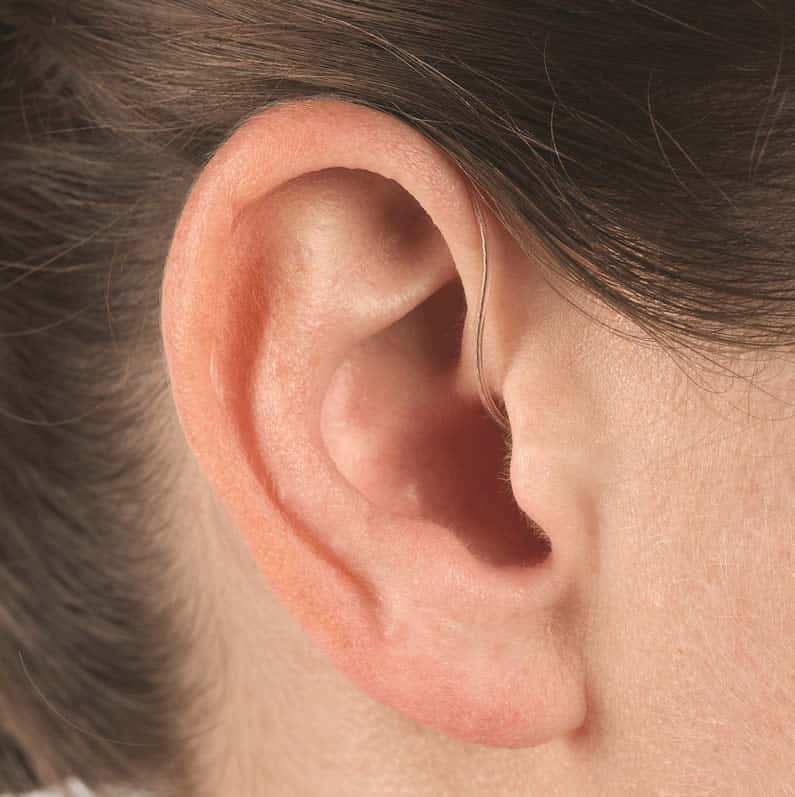 A Unitron Moxi Hearing Aid in situ is almost invisible