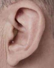 CIC Hearing Aid