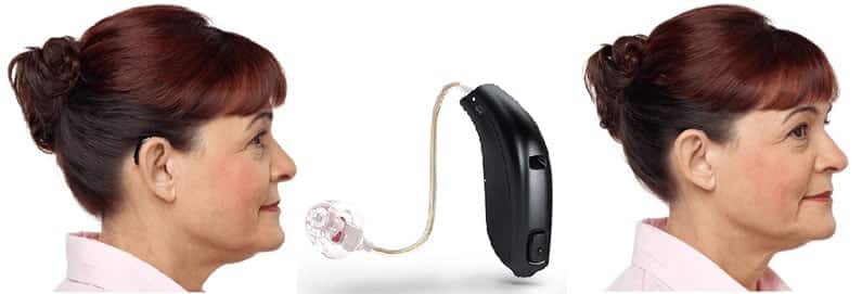 Oticon Alta miniBTE Hearing aid